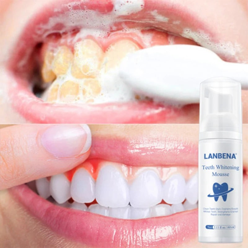 teeth corrector